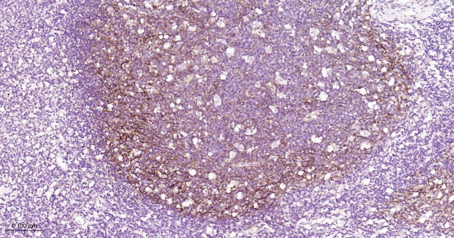 血管内皮细胞粘附分子（CD106）重组兔单抗