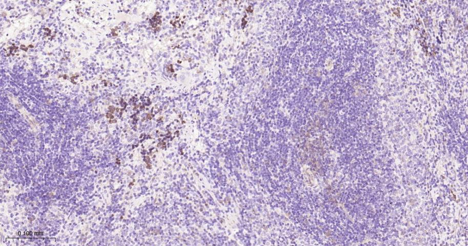 胸苷酸合成酶重组兔单抗-bsm-60680R