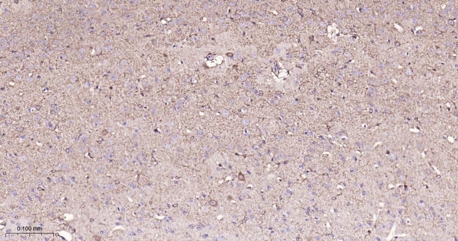 脂肪分化相关蛋白重组兔单抗