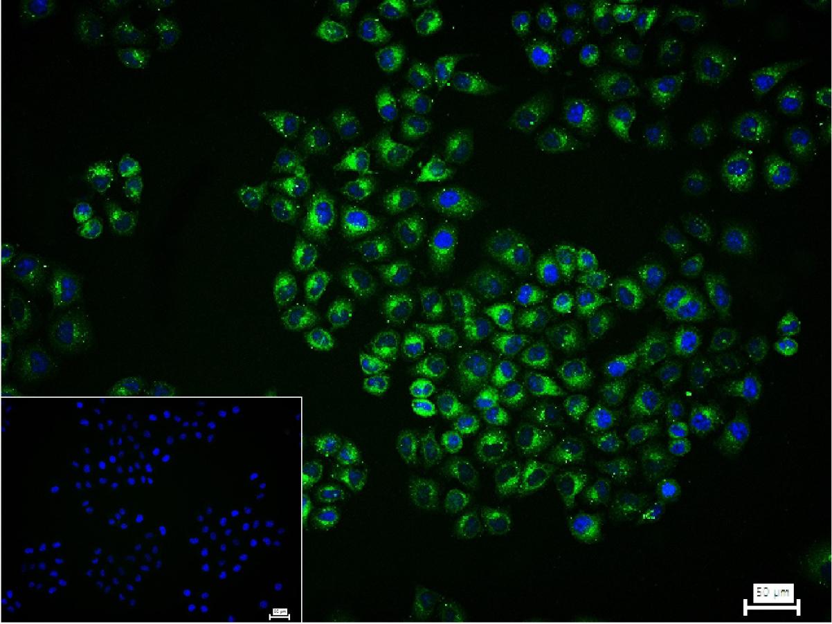 泛素结合蛋白P62抗体-bs-55207R
