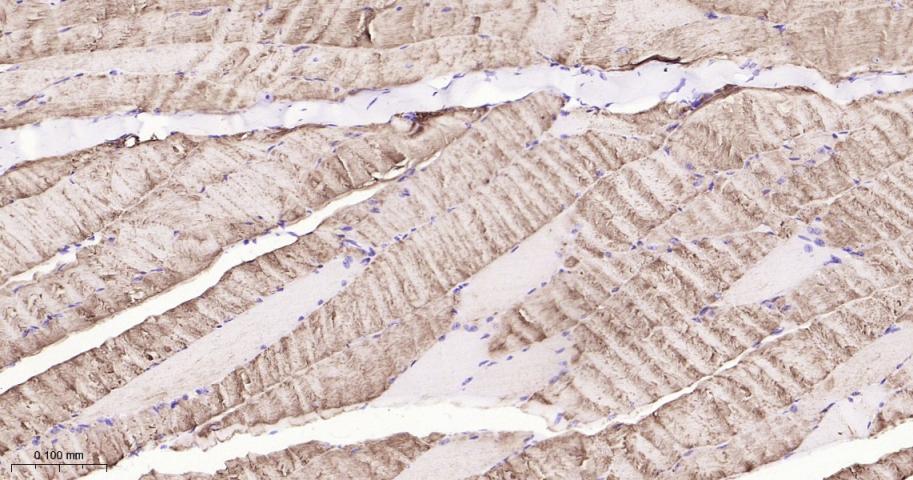 脂肪分化相关蛋白重组兔单抗