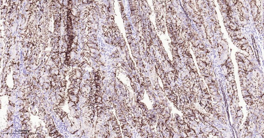 紧密连接蛋白7重组兔单抗