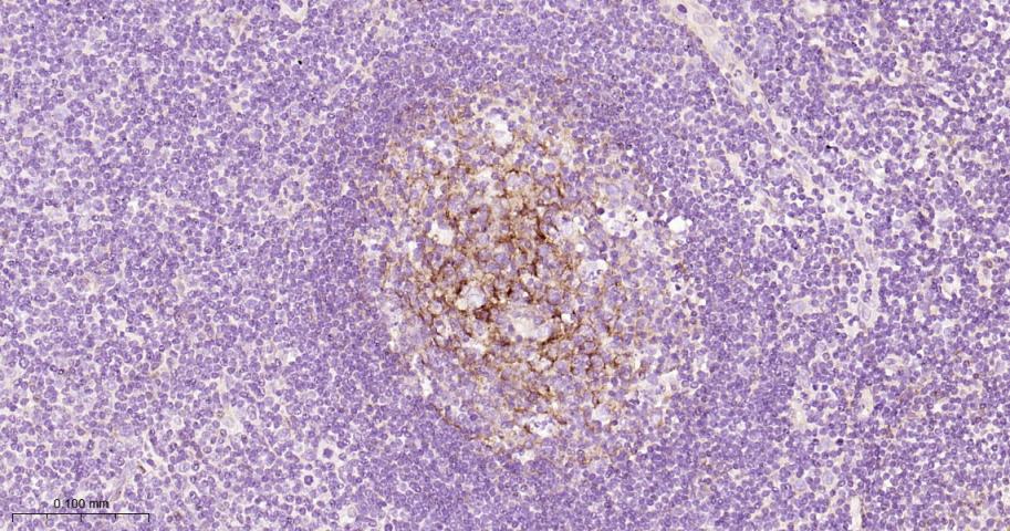 血管内皮细胞粘附分子（CD106）重组兔单抗