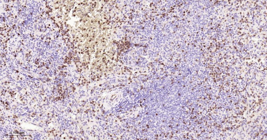 胸苷酸合成酶重组兔单抗-bsm-60680R