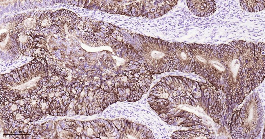 紧密连接蛋白7重组兔单抗