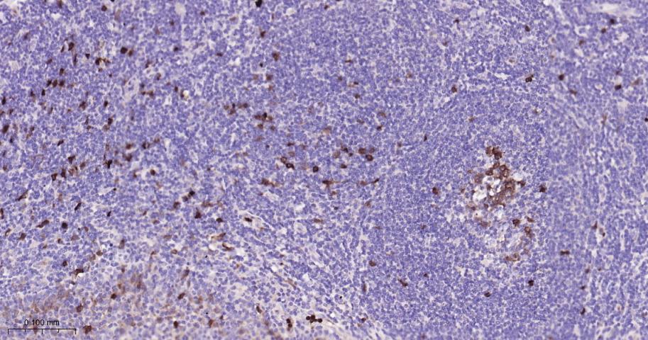 胸苷酸合成酶重组兔单抗-bsm-60680R