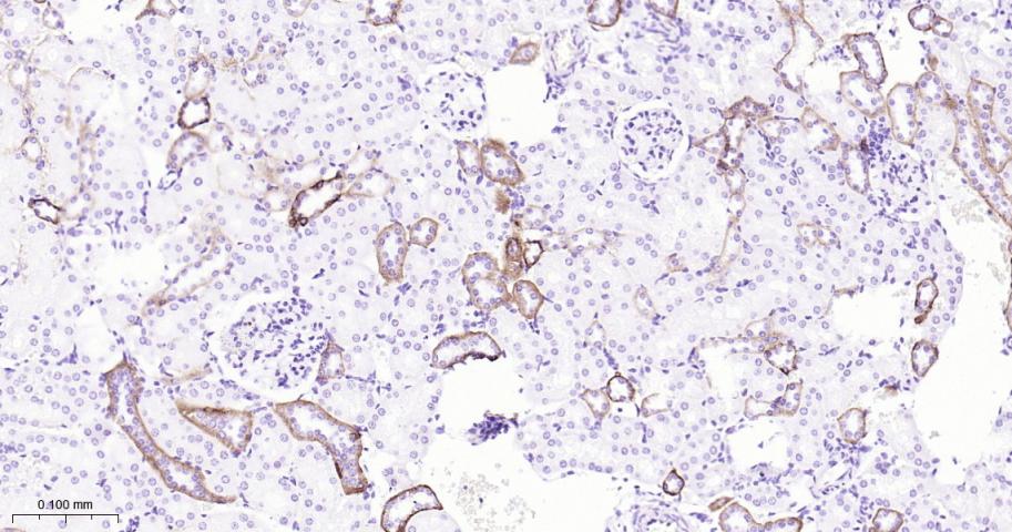 紧密连接蛋白7重组兔单抗