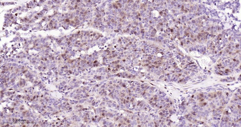 胸苷酸合成酶重组兔单抗-bsm-60680R