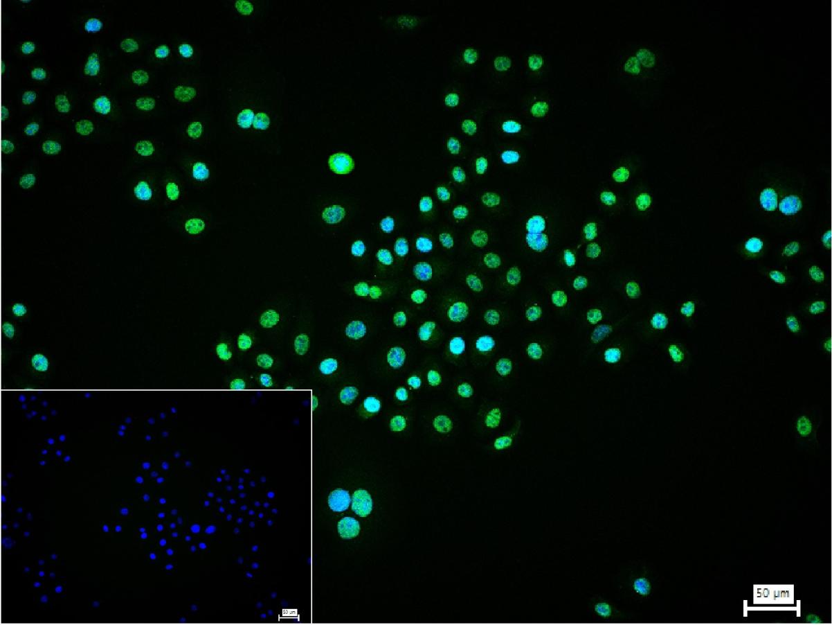肿瘤易感基因101蛋白抗体