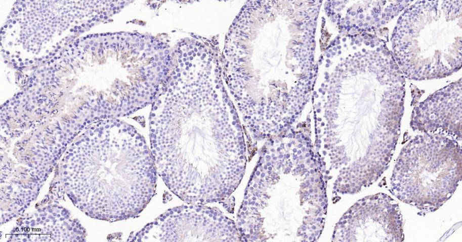 脂肪分化相关蛋白重组兔单抗