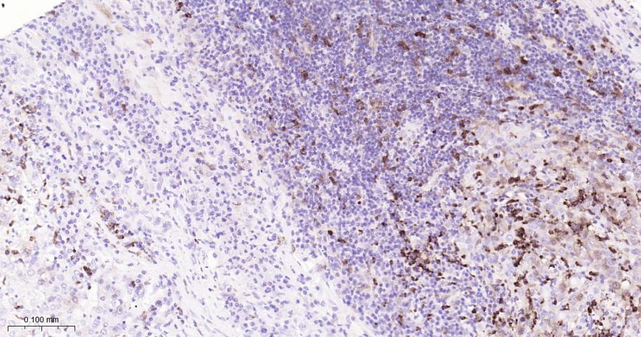 胸苷酸合成酶重组兔单抗-bsm-60680R