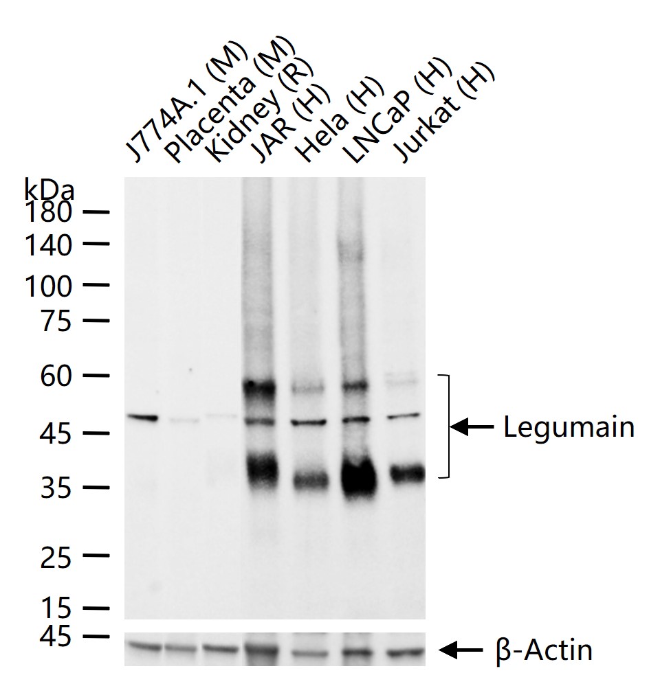 半胱氨酸蛋白酶重组兔单抗