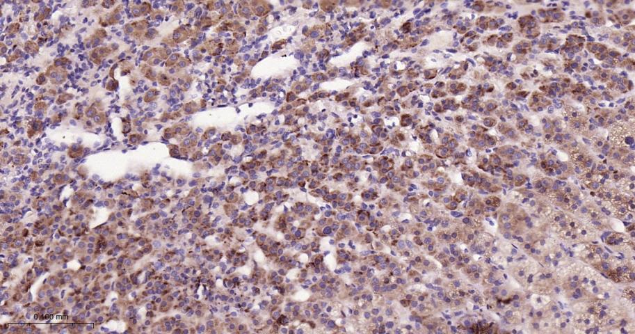 脂肪分化相关蛋白重组兔单抗