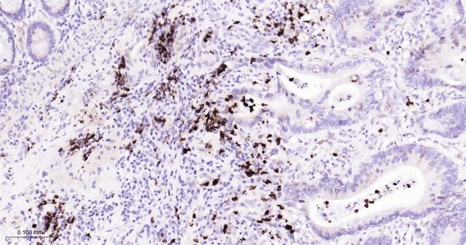 胸苷酸合成酶重组兔单抗-bsm-60680R