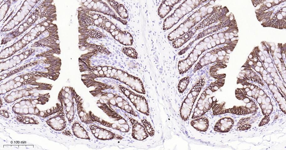 紧密连接蛋白7重组兔单抗
