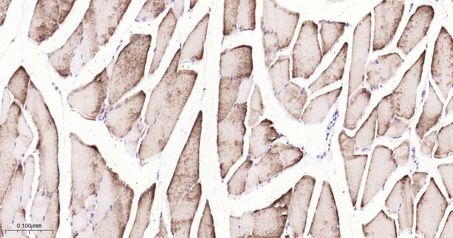 脂肪分化相关蛋白重组兔单抗