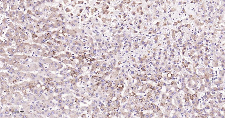 脂肪分化相关蛋白重组兔单抗