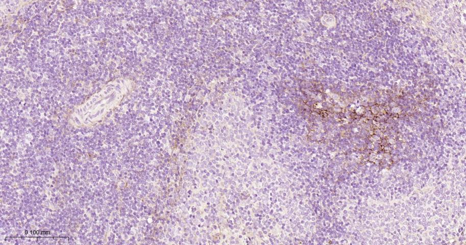 血管内皮细胞粘附分子（CD106）重组兔单抗