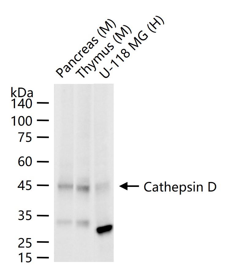 组织蛋白酶D重组兔单抗