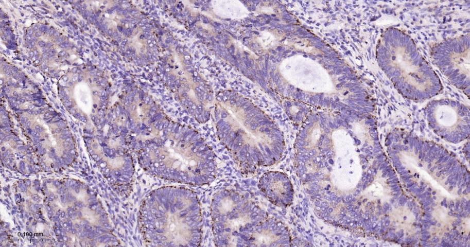 脂肪分化相关蛋白重组兔单抗