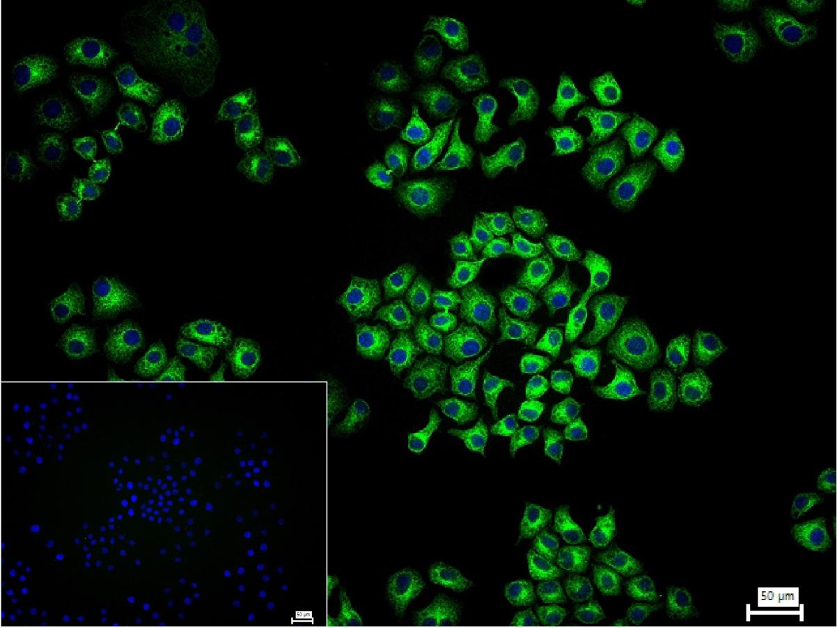 细胞色素P450 2D6重组兔单抗-bsm-61641R