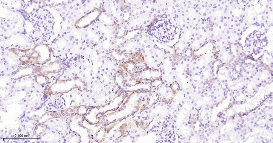 紧密连接蛋白7重组兔单抗