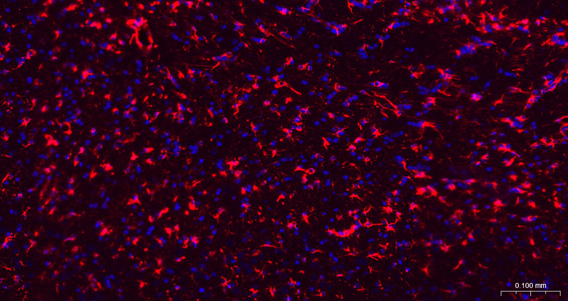 胶质纤维酸性蛋白单克隆抗体-bsm-42001M