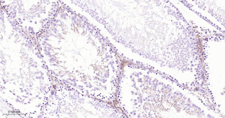 脂肪分化相关蛋白重组兔单抗