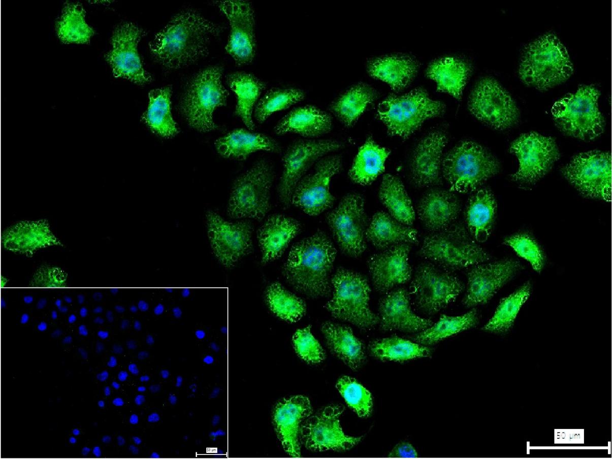 ALYREF重组兔单抗