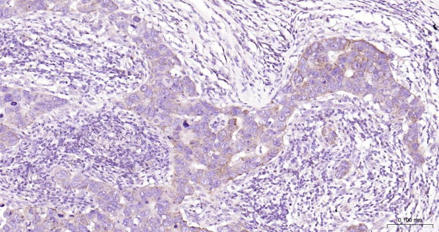 骨形态发生蛋白4重组兔单抗