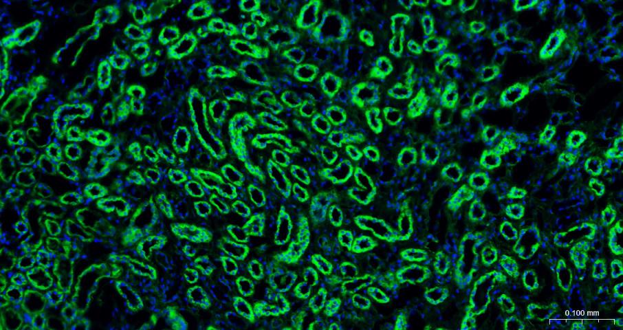 BF488标记的钙网蛋白抗体