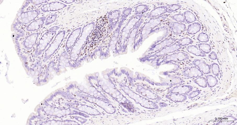 果糖-2,6-二磷酸酶3/磷酸果糖激酶2重组兔单抗-bsm-61693R