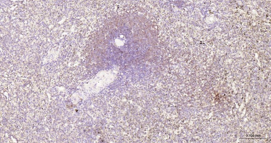 Bcl-2重组兔单抗