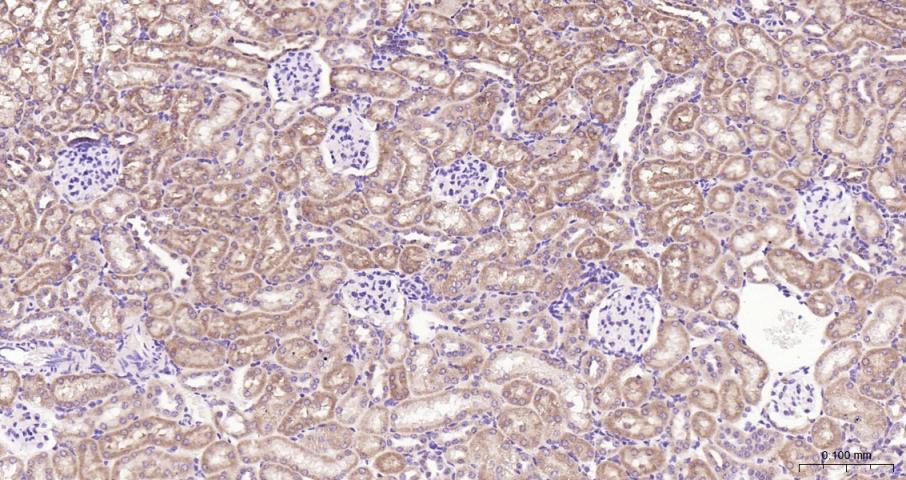 促凋亡调节蛋白BNIP3重组兔单抗