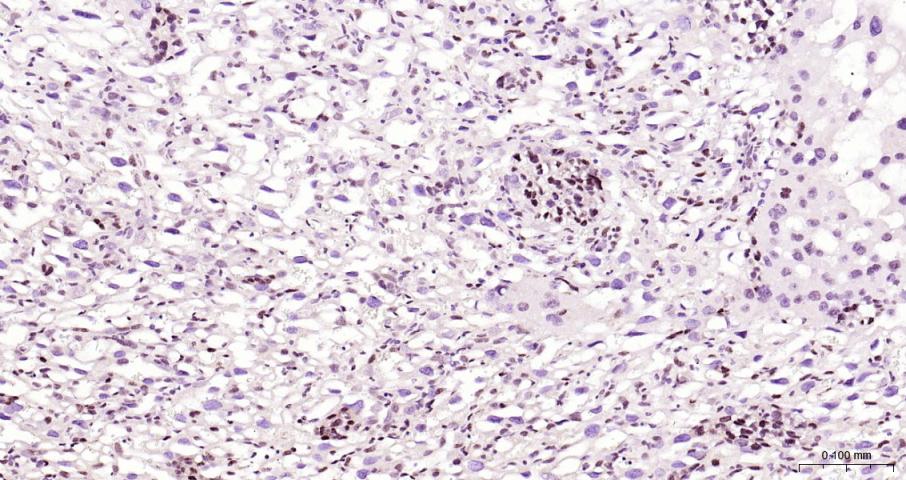 DNA甲基转移酶1重组兔单抗