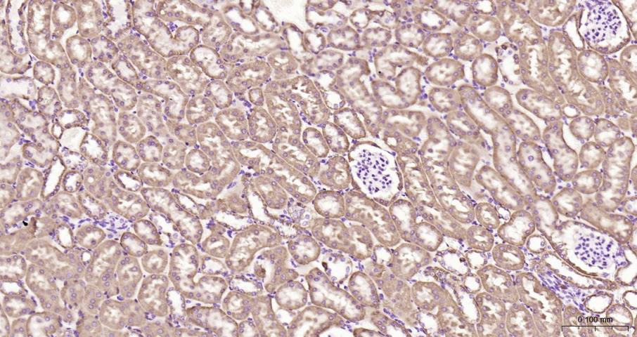细胞色素c氧化酶IV亚型1(内参)重组兔单抗