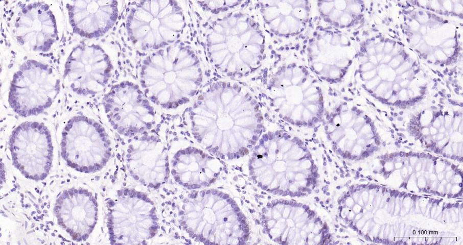 果糖-2,6-二磷酸酶3/磷酸果糖激酶2重组兔单抗-bsm-61693R