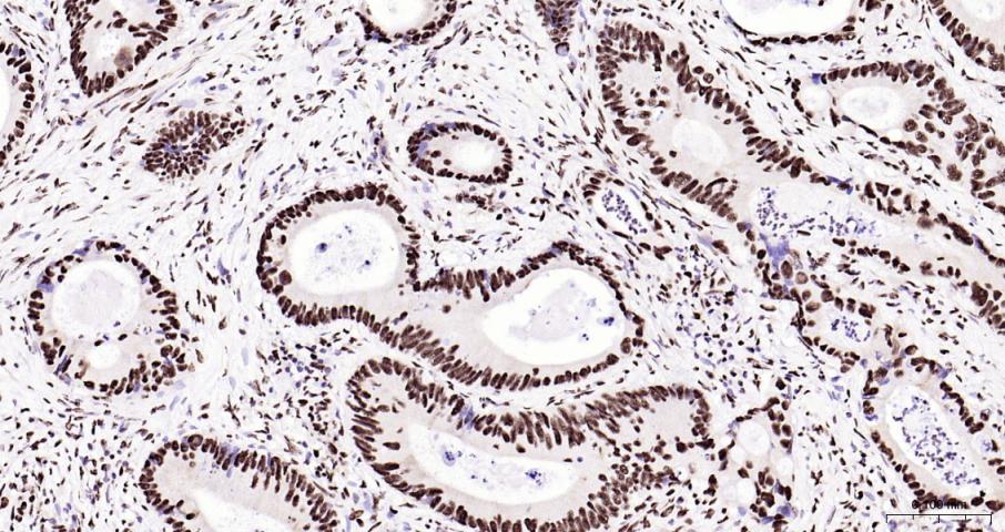 磷酸化双微体2癌基因重组兔单抗