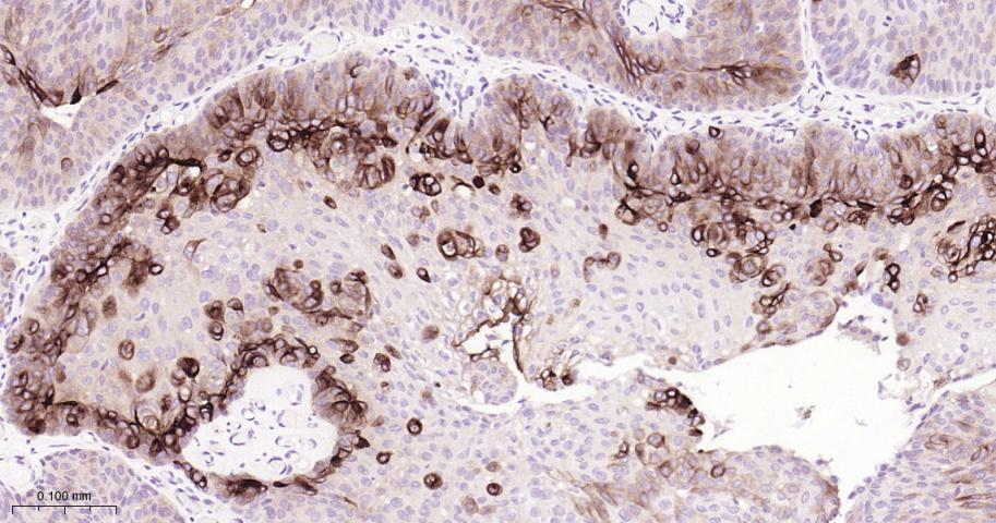 尿路上皮特异蛋白3重组兔单抗