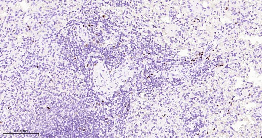 干扰素调节因子4重组兔单抗