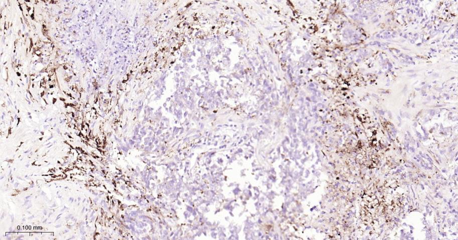 核因子2相关因子2重组兔单抗