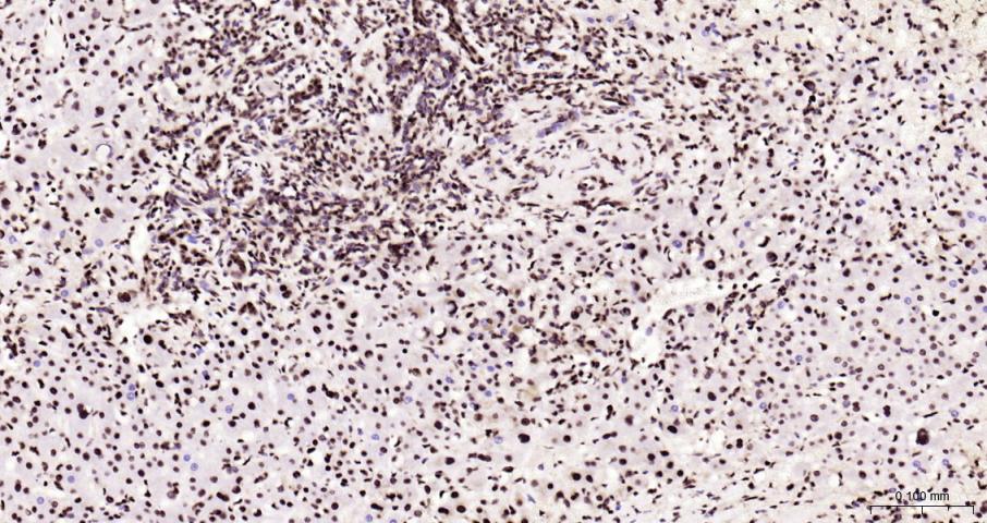 磷酸化双微体2癌基因重组兔单抗