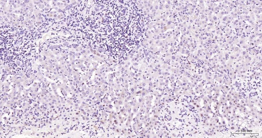 果糖-2,6-二磷酸酶3/磷酸果糖激酶2重组兔单抗-bsm-61693R
