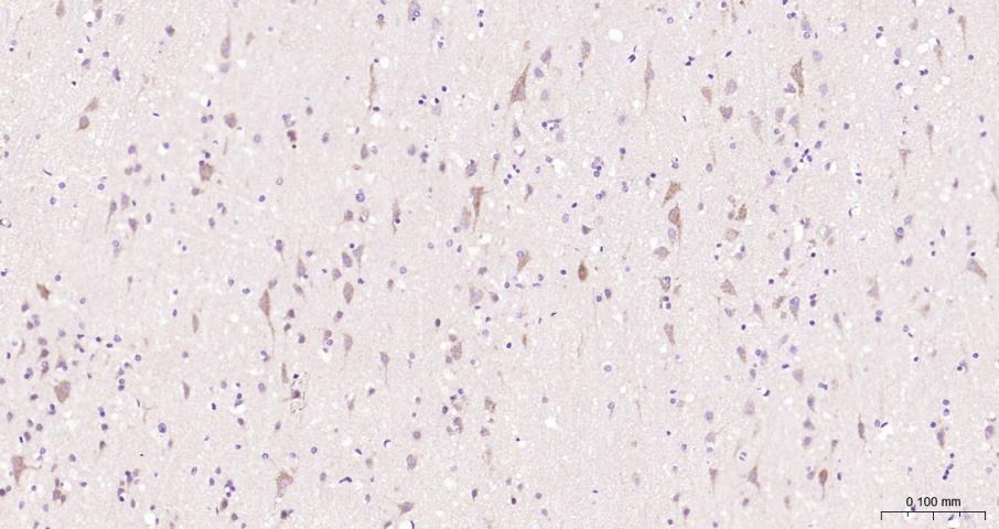 促凋亡调节蛋白BNIP3重组兔单抗