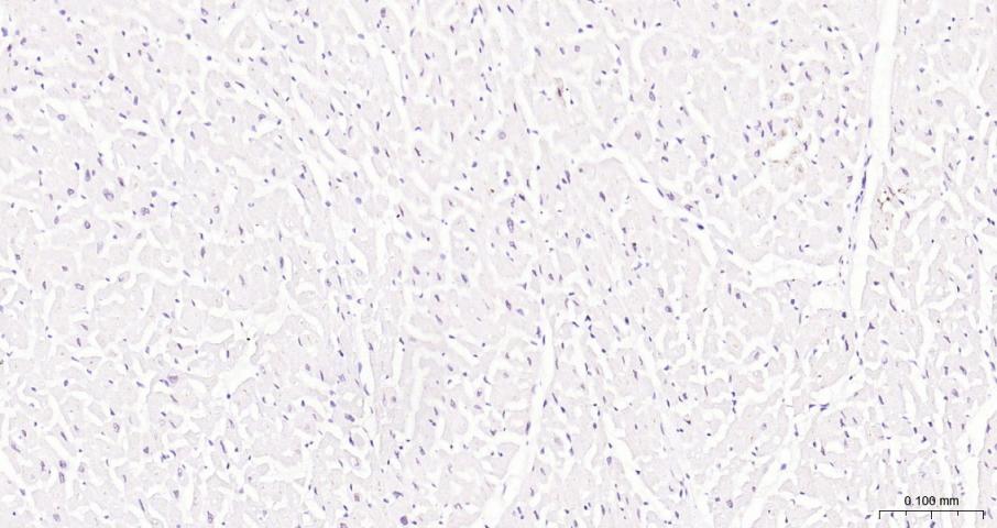 果糖-2,6-二磷酸酶3/磷酸果糖激酶2重组兔单抗-bsm-61693R