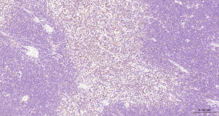 果糖-2,6-二磷酸酶3/磷酸果糖激酶2重组兔单抗-bsm-61693R