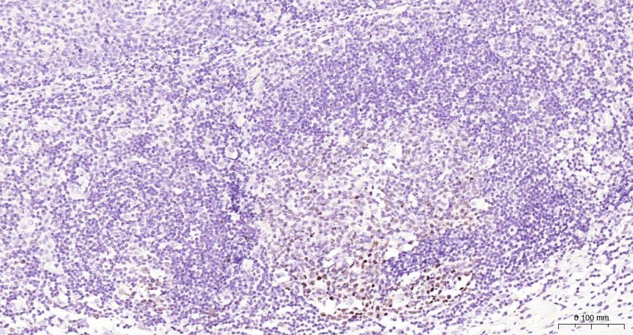 DNA甲基转移酶1重组兔单抗
