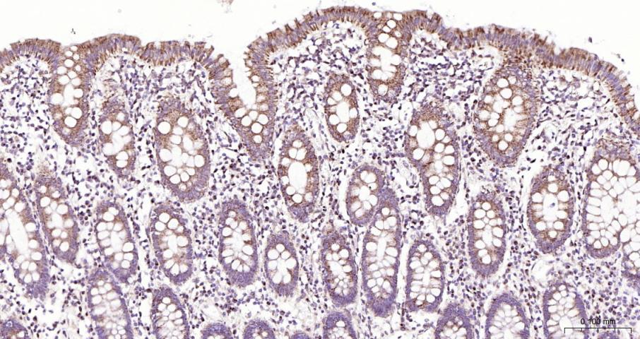 骨形态发生蛋白4重组兔单抗