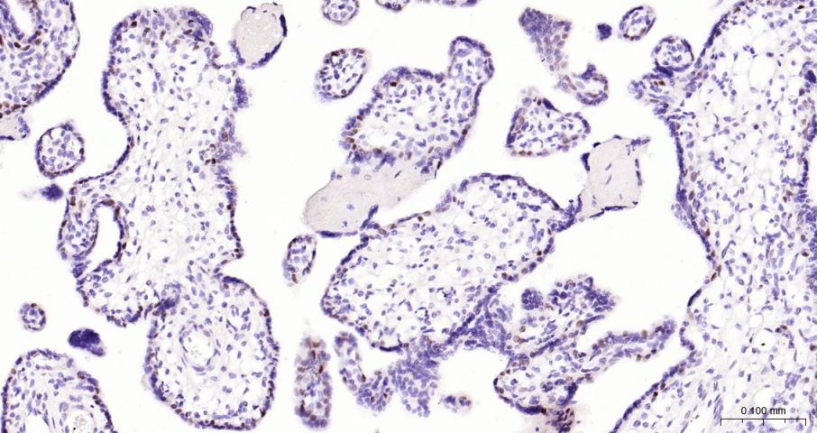 DNA甲基转移酶1重组兔单抗