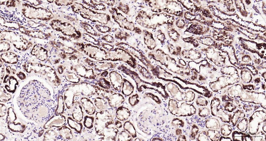 肾上腺皮质线粒体铁氧还蛋白重组兔单抗